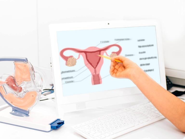 Osoba wskazuje długopisem na grafikę kobiecego narządu rozrodczego 